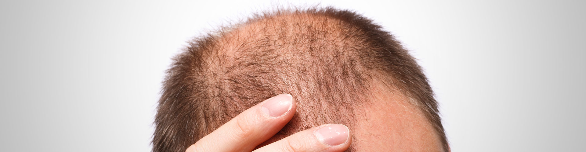 11 dicas de como tratar o cabelo caindo